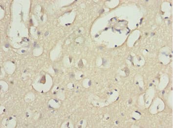 MOCS3 Antibody