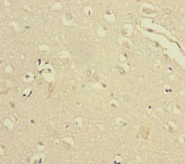 VPS33B Antibody