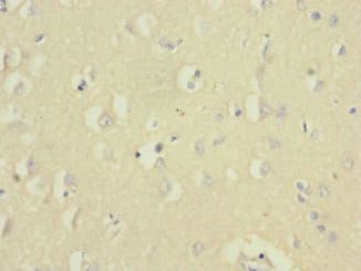 UBE2F Antibody