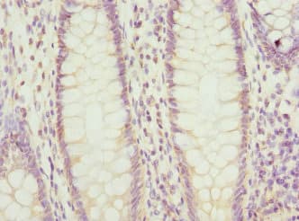 PTGES2 Antibody