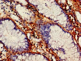 VEGFB Antibody