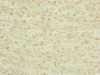 DHTKD1 Antibody