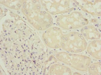 ZFYVE16 Antibody