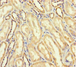 DARS2 Antibody