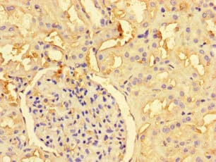 PRMT6 Antibody