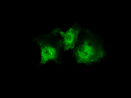 Monoclonal Mouse anti-Human PLEK / Pleckstrin Antibody (clone OTI6B5, IHC, IF, WB)
