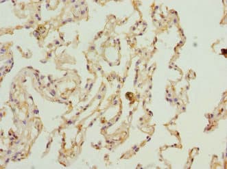 PECR Antibody