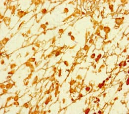 JMJD1C Antibody