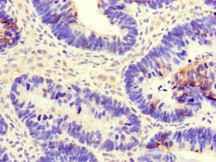 CEP290 Antibody