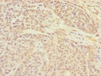 CETN3 Antibody