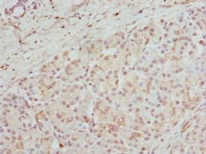 GPD2 Antibody