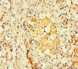 TBC1D24 Antibody