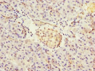 CRIP2 Antibody