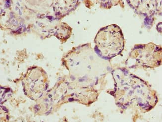 BPGM Antibody