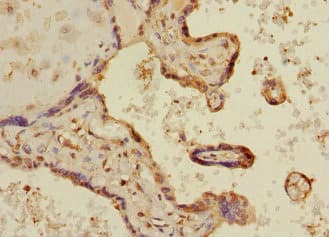 MAPKAPK3 Antibody