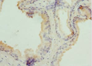 TPD52L1 Antibody