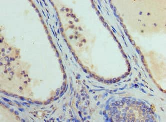 GATA1 Antibody