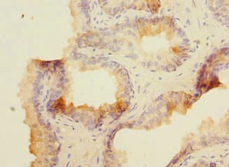MAP4K5 Antibody