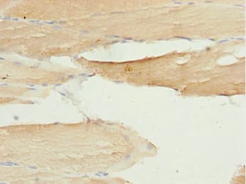 LZTR1 Antibody