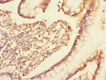 TRIAP1 Antibody