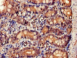 IL34 Antibody