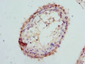 GPD2 Antibody