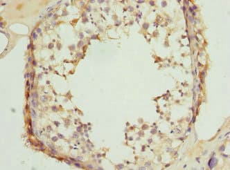 CLASP1 Antibody