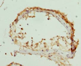 ZDHHC17 Antibody