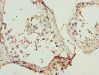 ULK4 Antibody