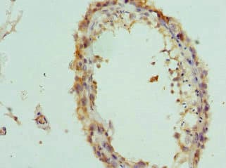 IL20 Antibody