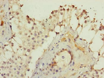 KIAA0391 Antibody