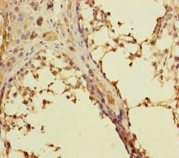 RAB27B Antibody