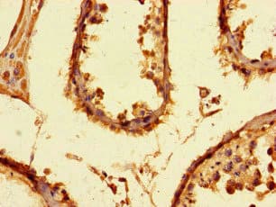 PRMT6 Antibody