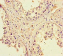 DNMT3B Antibody