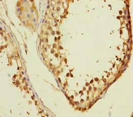 VPS33B Antibody