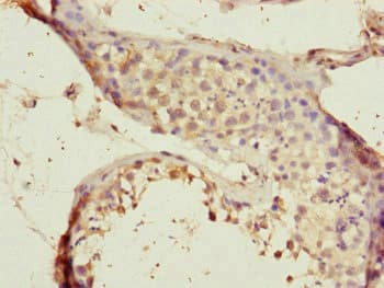 CEP72 Antibody