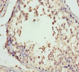 GNS Antibody