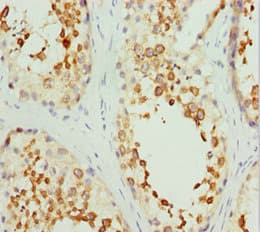RCN2 Antibody