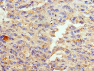 GATA1 Antibody