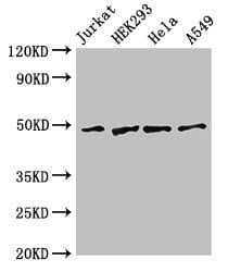 GABPB2 Antibody