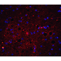 TNFSF10 / TRAIL Antibody (C-terminal)