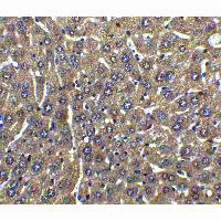 Polyclonal Rabbit anti-Human CFLAR / FLIP Antibody (IHC, IF, WB)