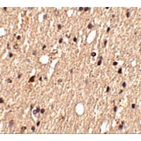 Polyclonal Rabbit anti-Human SPRED1 Antibody (IHC, WB)
