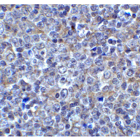 Polyclonal Rabbit anti-Human LAG3 Antibody (IHC, IF, WB)