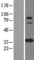 IFI16 Protein (Over-Expression Lysate Myc-DDK (Flag))