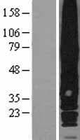 GPRC5A / RAI3 Protein (Over-Expression Lysate Myc-DDK (Flag))