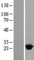 OPRS1 / SIGMAR1 Protein (Over-Expression Lysate Myc-DDK (Flag))