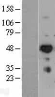 IRF6 Protein (Over-Expression Lysate Myc-DDK (Flag))