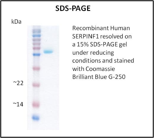 Human SERPINF1 / PEDF Protein (Recombinant)
