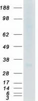 Human ACKR1 / DARC Protein (Recombinant Myc-DDK (Flag))
